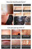 Nose Blackhead Remover